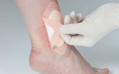 New Medical Adhesive Silicone Foam Dressing